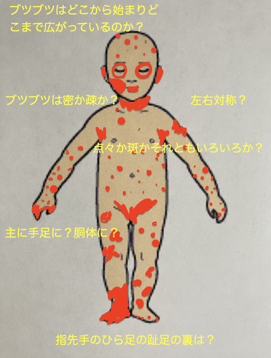 皮疹の診察