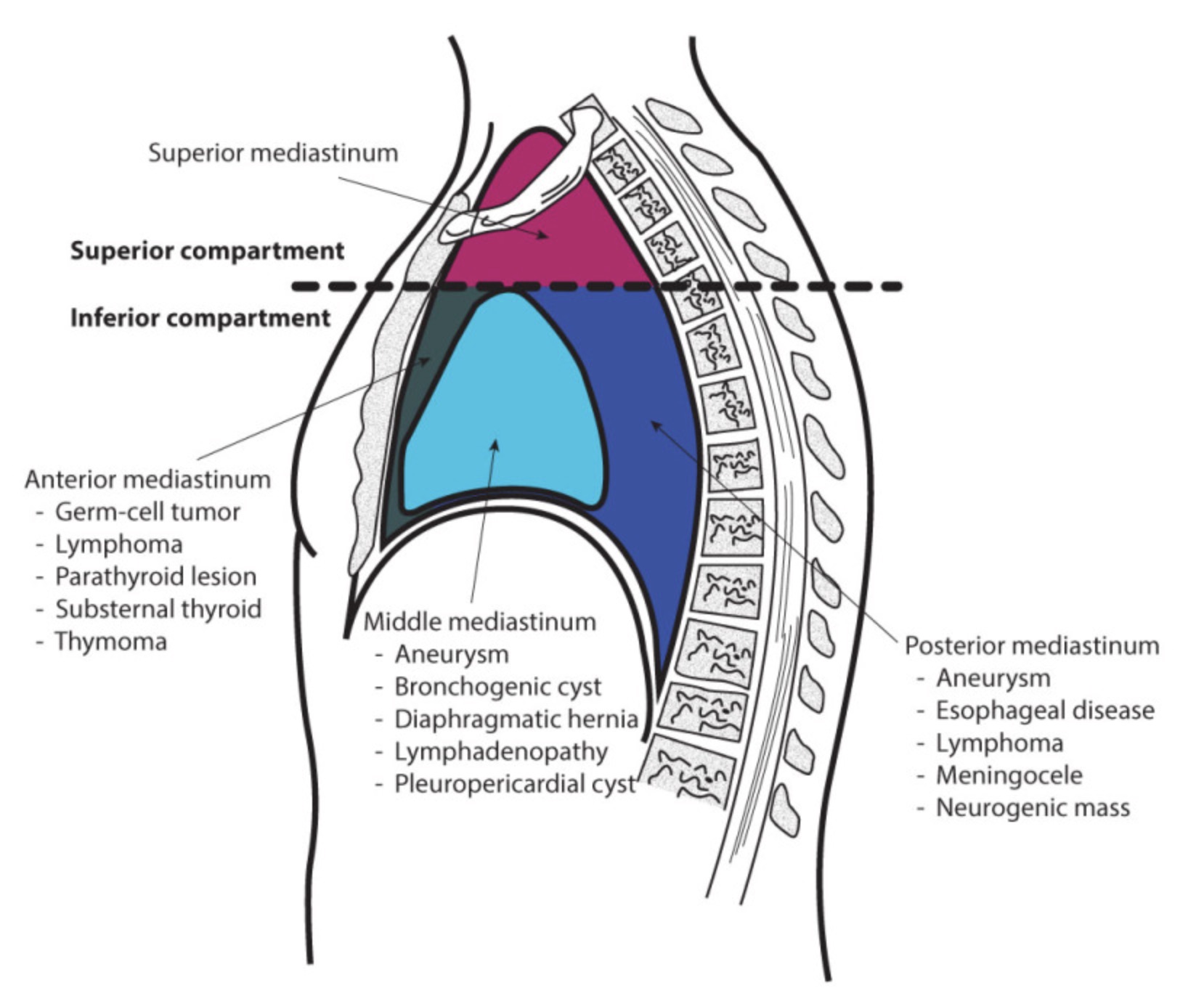 上前中後縦隔図